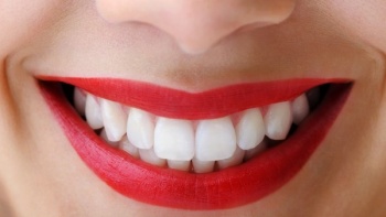 Estetik Diş Hekimliği (Diş Kaplama)