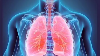 Akciğer Embolisinin Belirtileri Nedir?